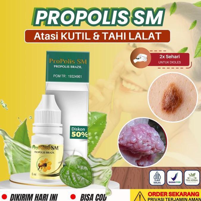 Cairan Tetes PROPOLIS SM - Perawatan Untuk Kutil TaHi lalat Hidup Papiloma Skintag Daging Tumbuh Kel