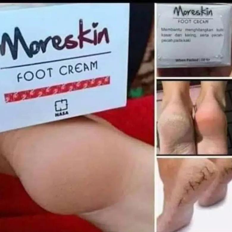 NEW Kaki pecah dan kering - Moreskin foot cream - Obat kaki pecah2 - Obat kaki pecah2 dan kering [te