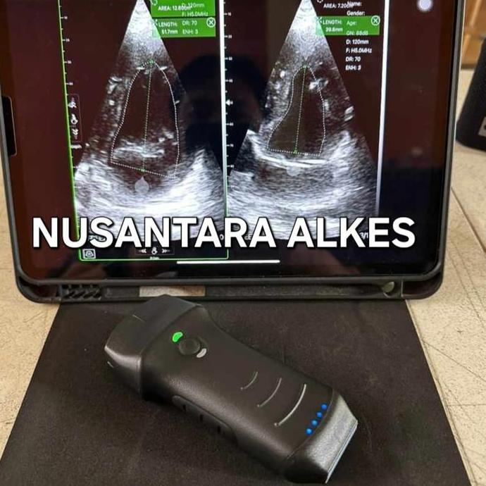 WIRELESS USG DOUBLE HEAD/ USG WIFI CARDIAC/ LINIER/ CONVEX 3 IN 1