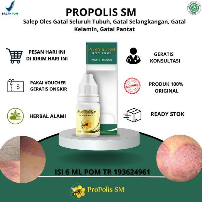 Propolis SM Salep Oles Gatal Seluruh Tubuh, Gatal Selangkangan, Gatal Kelamin, Gatal Pantat Koreng, 