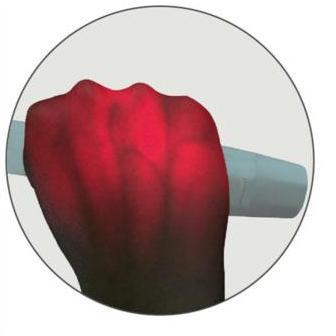 ------] Vein finder/ vein viewer/ alat pencari vena