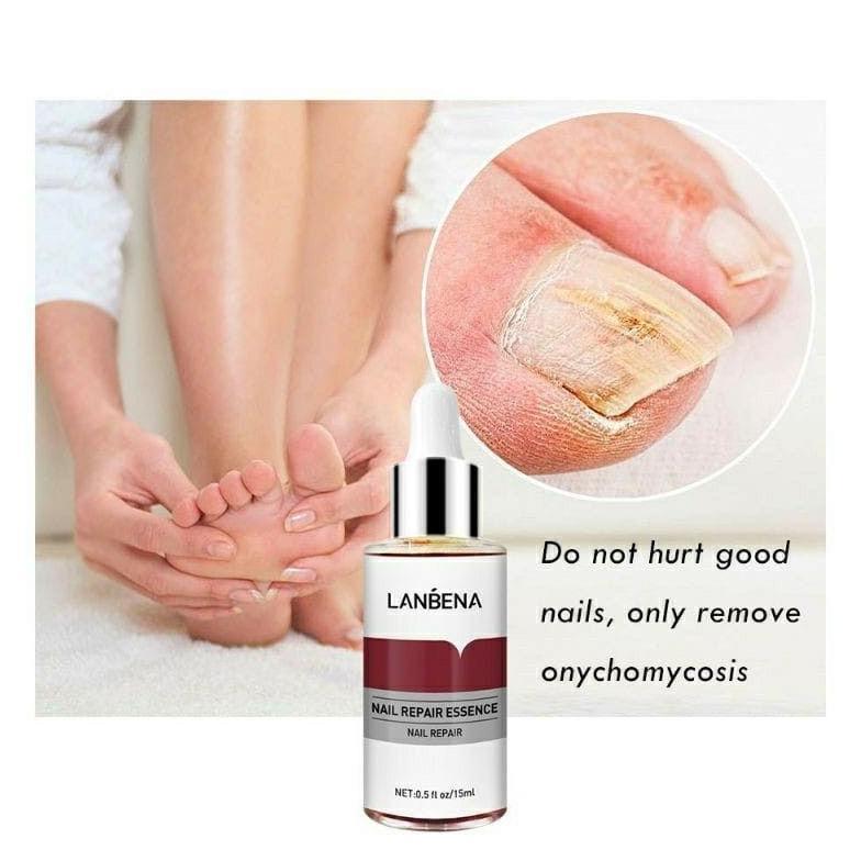 READY(BPOM)LANBENA Nail Repair Essence SERUM KUKU LANBENA / SERUM JAMUR KUKU