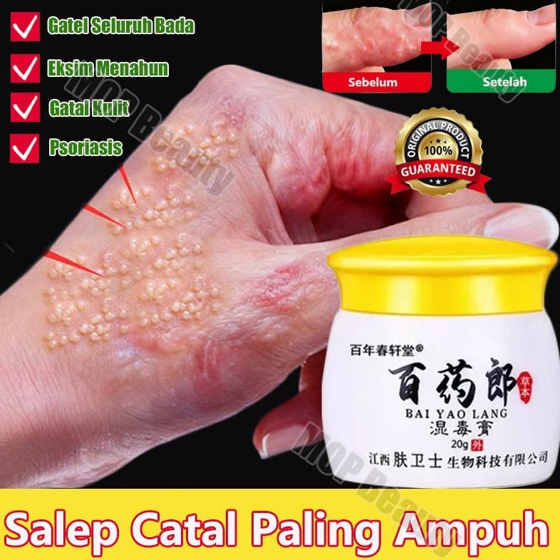 Terlaris Salep gatal salep eksim kering dan gatal salep china gatal paling ampuh eksim kering salep 