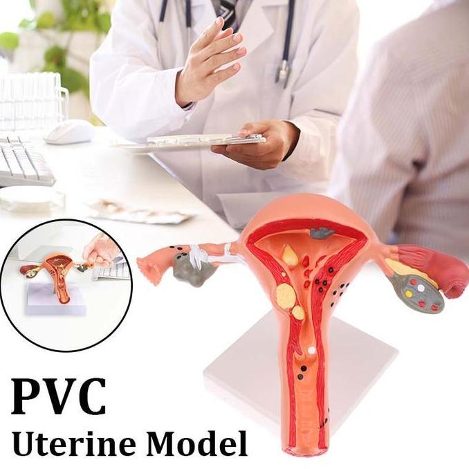 1set Uterus Anatomical Model Patologis Uterus Ovarium Alat Peraga Uterus Uterus Ovary Anatomical Mod