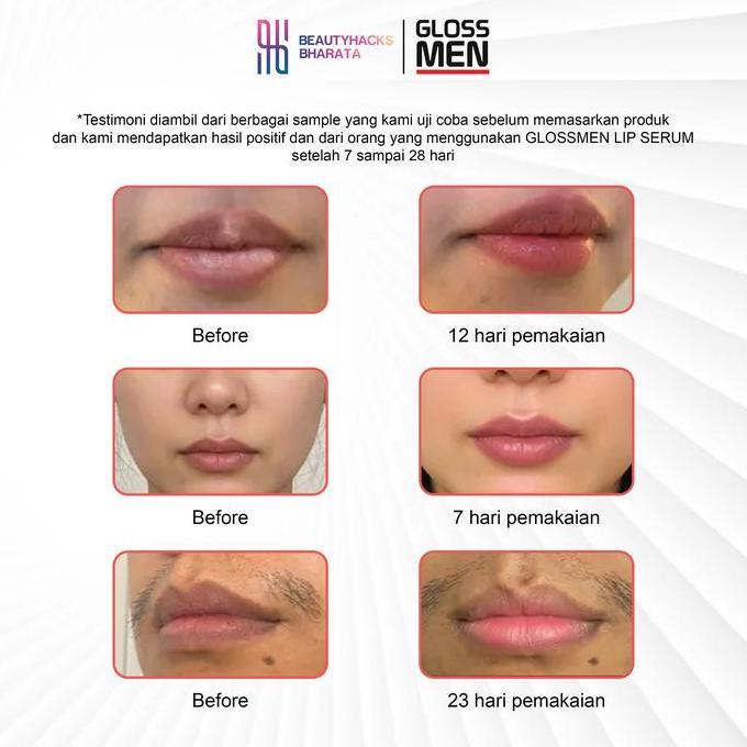 Webyzoraa - GlossMen Lip Serum Pemerah Bibir Pria Alami - RESMI BPOM