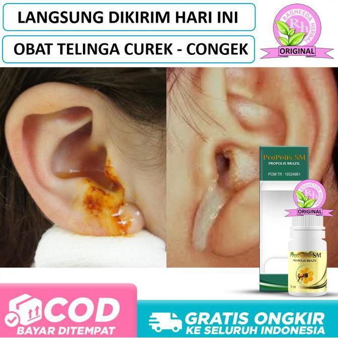 Obat Telinga Congek, Curek, Berdenging, Bernanah, Berair Kuning Bau