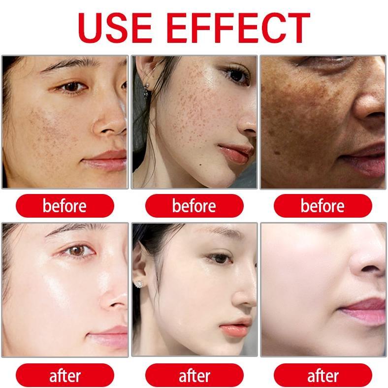 bpom30ml serum flek hitam membandel serum pencerah wajah+glowing serum untuk flek hitamserum melasma