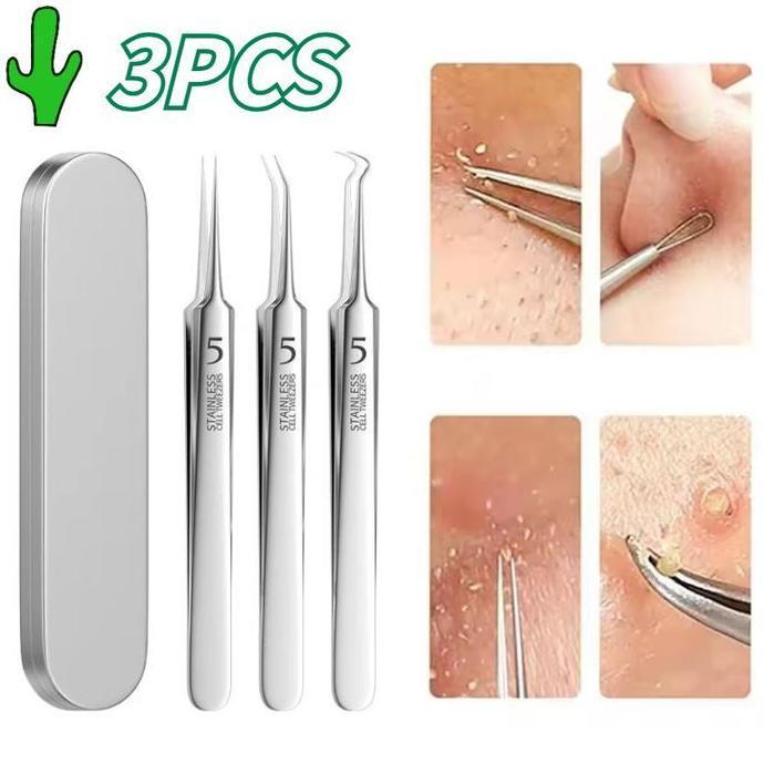 RGPOTZ 3Pcs Lurus Pinset Klip Penghilang Komedo Hidung Alat Jerawat Pinset Jepit Komedo Stainless St