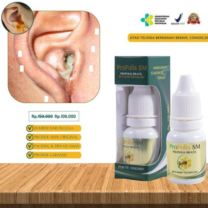 Propolis Sm Atasi Masalah Telinga Sakit Bernanah Berair Tanpa Efek Samping Tetes Ear Gatal ofloxacin