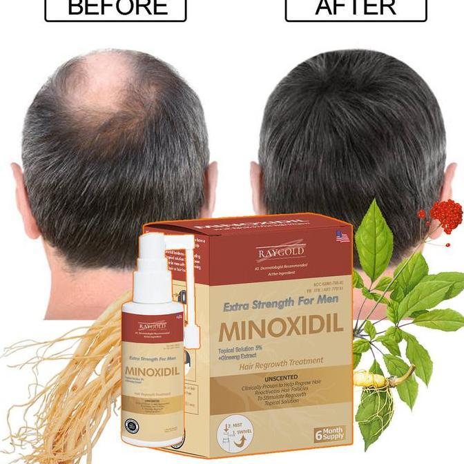 MINOXIDIL5%penumbuh rambut & brewok with Ginseng extract for MEN made in USA - RAYGOLD -  MINOX MINO