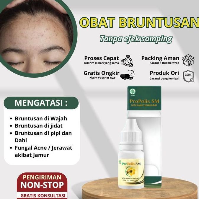 SOBIREN_SHOP - JERAWAT PASIR BRUNTUSAN HERBAL PENGHILANG BRUNTUSAN KECIL DI MUKA TETES PENGHILANG BE
