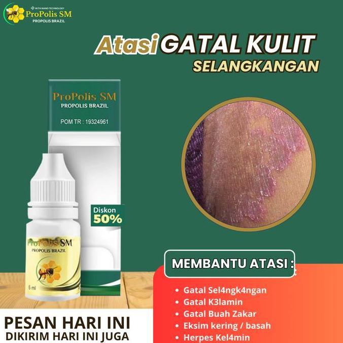 Salep Oles Untuk Gatal Seluruh Badan Pada Anak dan Dewasa, Penghilang Gatal Selangkangan, Gatal K3la