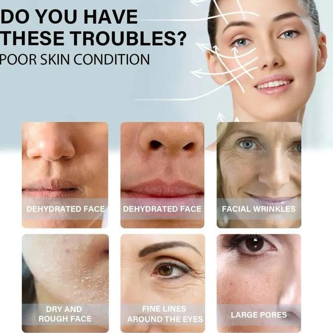 IMPORT 120PCS NO NEEDLE GOLD PROTEIN LINE ABSORBABLE ANTI-WRINKLE FACE FILLER LIFT FIRMING COLLAGEN 