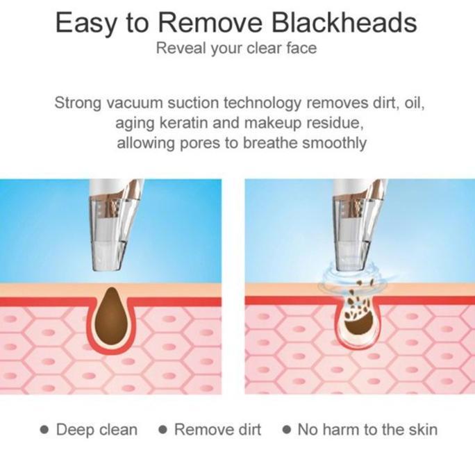 READY Alat Penyedot Komedo dan Jerawat Vakum Komedo /Alat Komedo Facial /Alat Sedot Komedo Listrik &