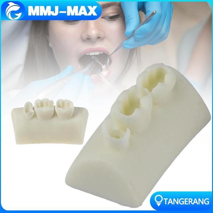NUMAQUEEN Model Latihan Tambal Gigi/Model Tambalan Gigi/Dental Practice Model