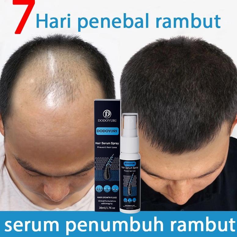 BPOMSerum penumbuh rambut penumbuh rambut botak penebal rambut penumbuh rambut cepat 30ml hair tonic