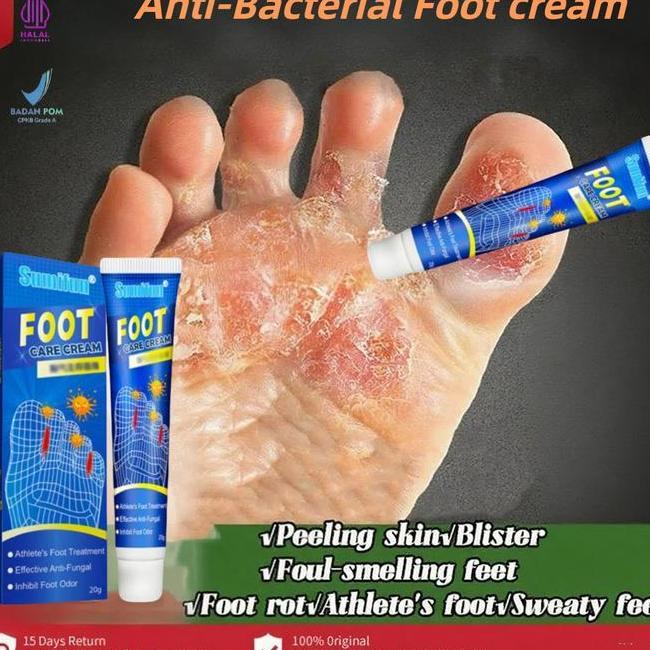 Kaki Rayapan Dan Bau P Gatal Krim Pengelupas Kulit Mati Kaki Pembersih Kulit Mati Tumitku Kapalan Ta