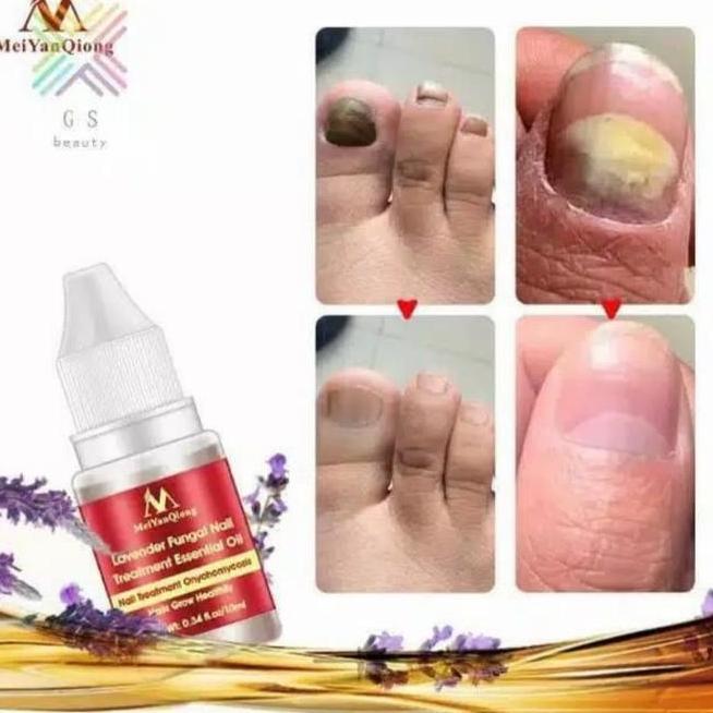 Meiyanqiong Krim Pelembap Kaki Apalan Anti Retak Perawatan Kaki