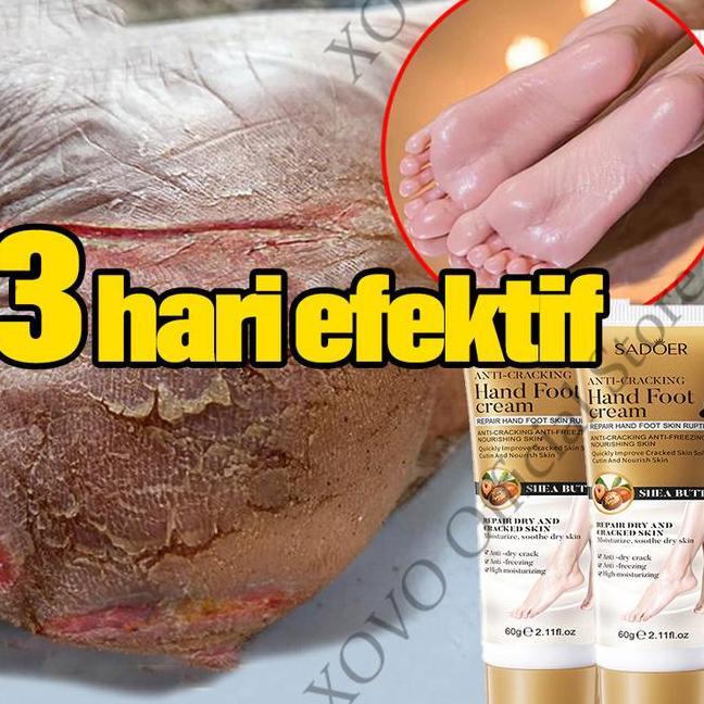 Pelembab Kaki Pecah Dan Kering Kaki Kaki Pecah Dan Kering Krim 60G P Kaki Pecah Pecah Kering