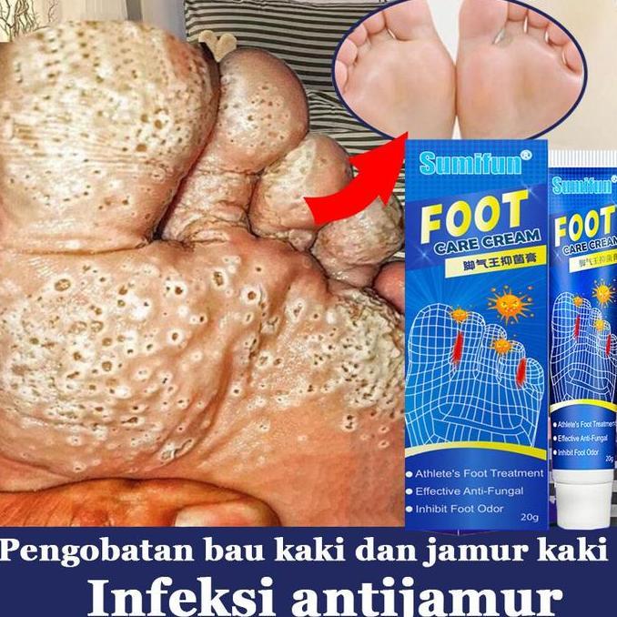Ratratama54 - Salep Kaki Ampuh obat kaki Rayapan Dan Bau penghilang bau kaki obat jamur kaki pembers