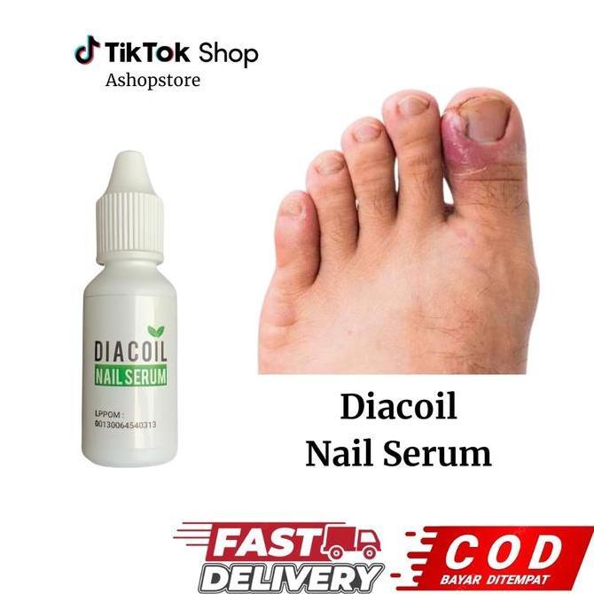 Nail- Diacoil Nail Serum Peratan Jamur Kuku Dan Kuku Cantengan, 20Ml