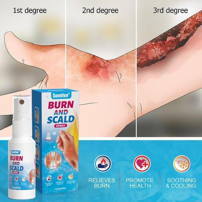 Krim pelembap tubuh Cream Salep Luka Bakar LUKA BAKAR KRIM PERAWATAN KULIT BEKAS LUKA MELEPUH 30ml S