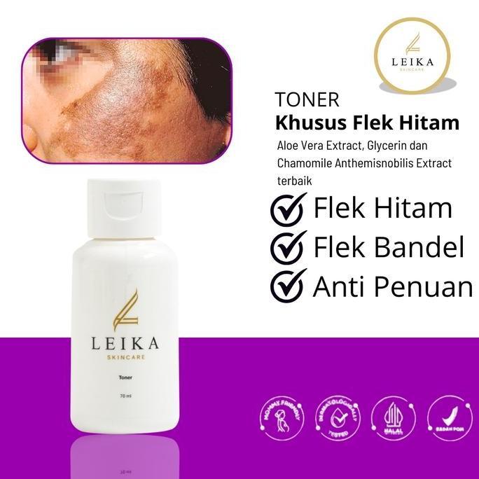TONER KHUSUS FLEK HITAM toner yang di formulasikan khusus untuk mengatasi flek hitam Toner Leika Ski