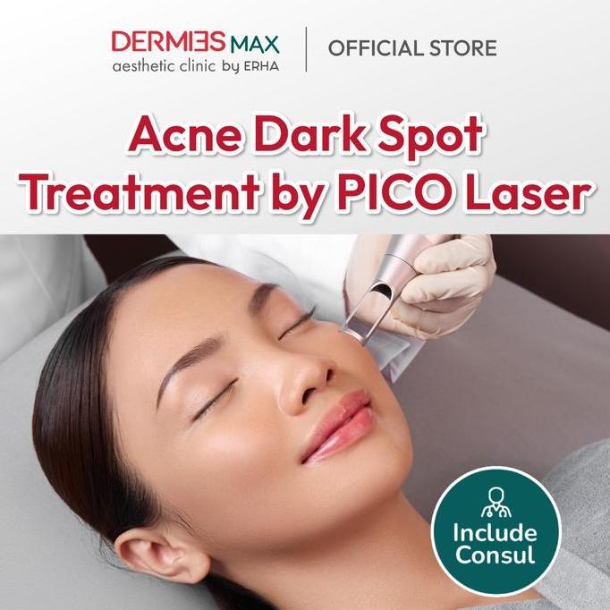 Dermies Max Acne Dark Spot Treatment by PICO Laser