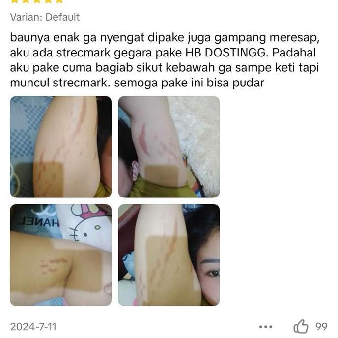 PURNAMA_DINDAA - [BELI 2 LEBIH HEMAT] ALEYA STRETCH MARK CREAM KRIM PENGHILANG STRETCH MARK BUMIL AL