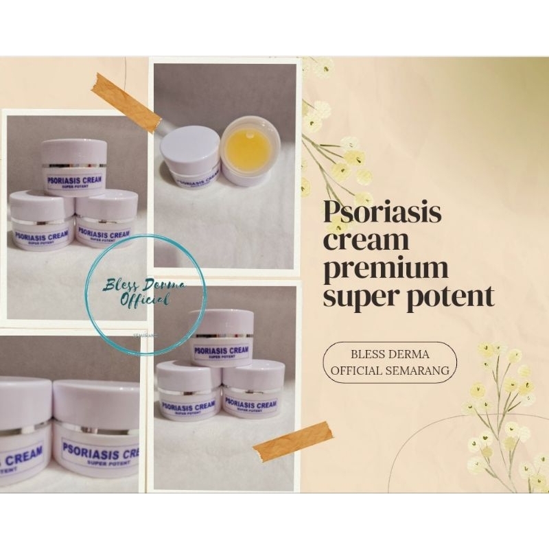 TERBUKTI AMPUH !! Psoriasis Cream Premium Super Potent Obat Gatal Psroasis Eksim Badan Tangan Kepala Kaki Rambut