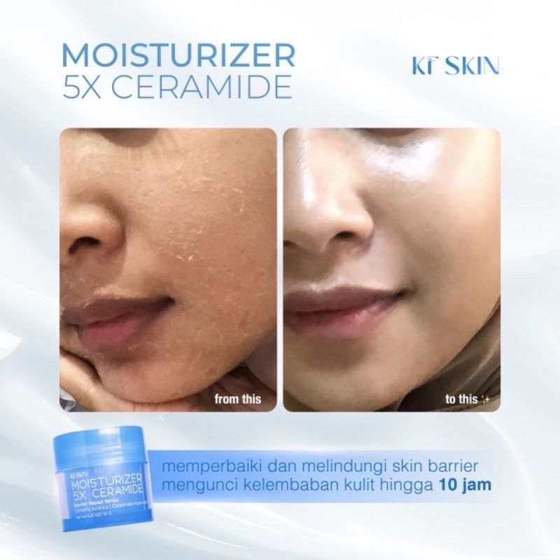 Moisturizer 5x ceremide kfskin bpom / KF Beauty