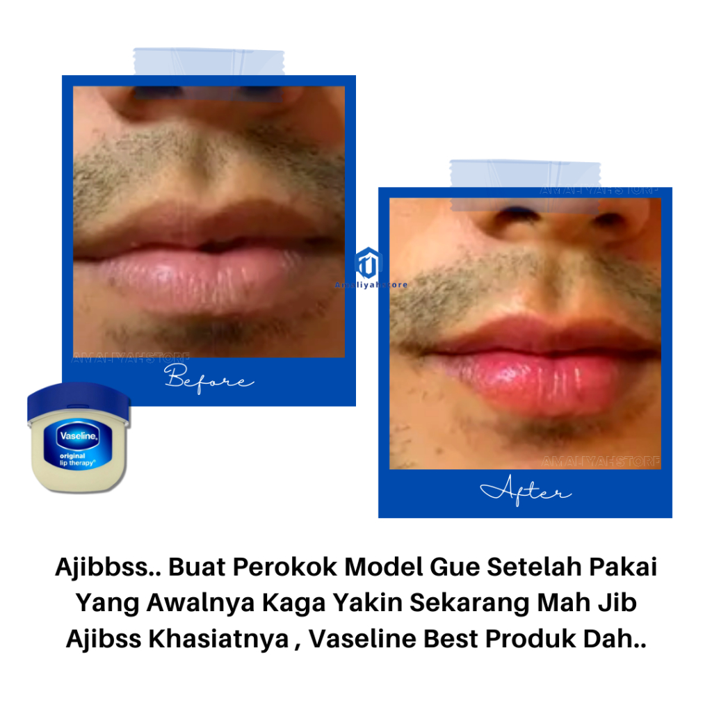 Lipbam Vaseline Masker Pemerah Untuk Pelembab Bibir Kering Hitam Tahan Lama Pria Dan Wanita Perokok Bikin Merah Permanen