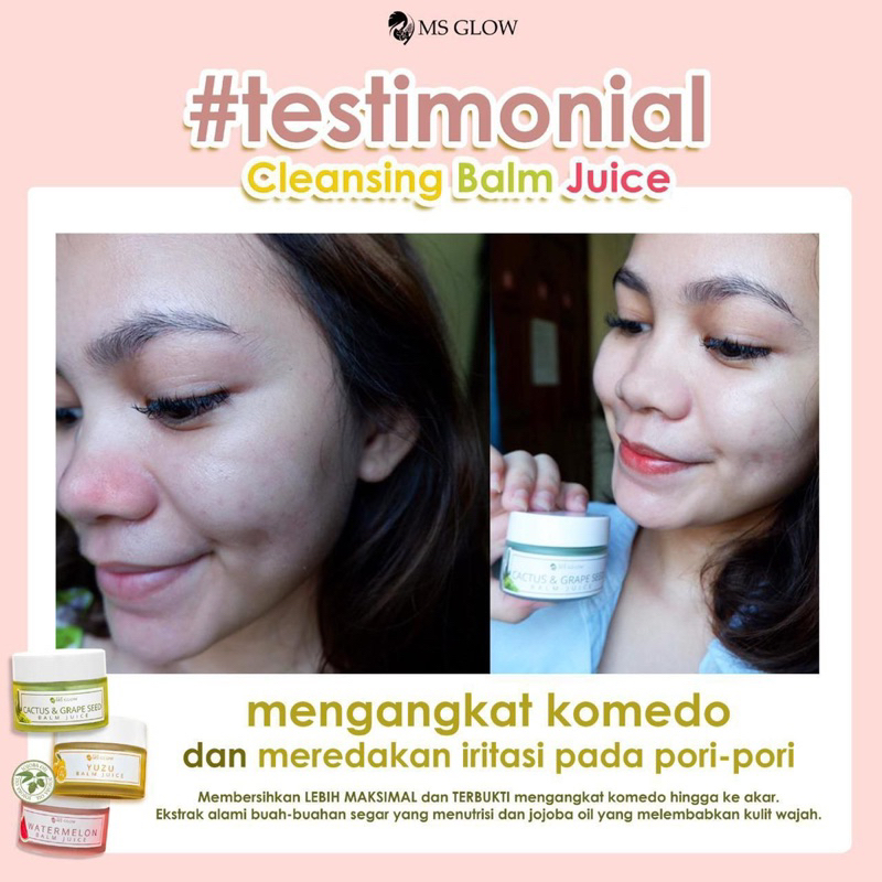 【Official Store】MS GLOW Cleansing Balm Juice Msglow | Pembersih Make up Waterproof Pelunak Komedo Hitam Anti Jerawat