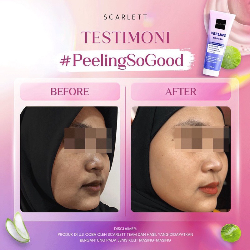 Scarlett Whitening Peeling So Good