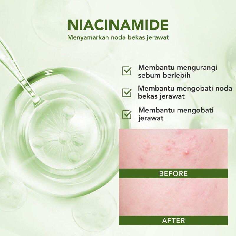 (BISA COD) YOU ACNE PLUS CICA HERBS DERMA SOLUTION