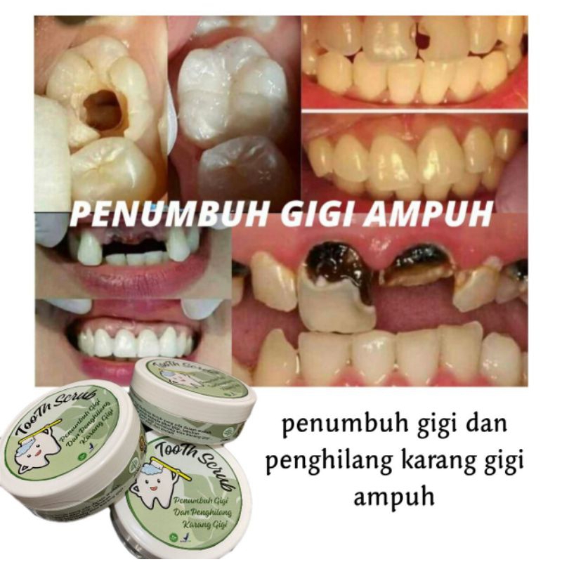 PENUMBUH-GIGI-OMPONG-KROPOS-ORIGINAL-AMPUH