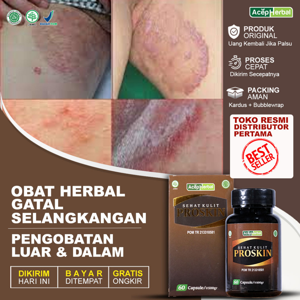 Obat Gatal Selangkangan Proskin Original