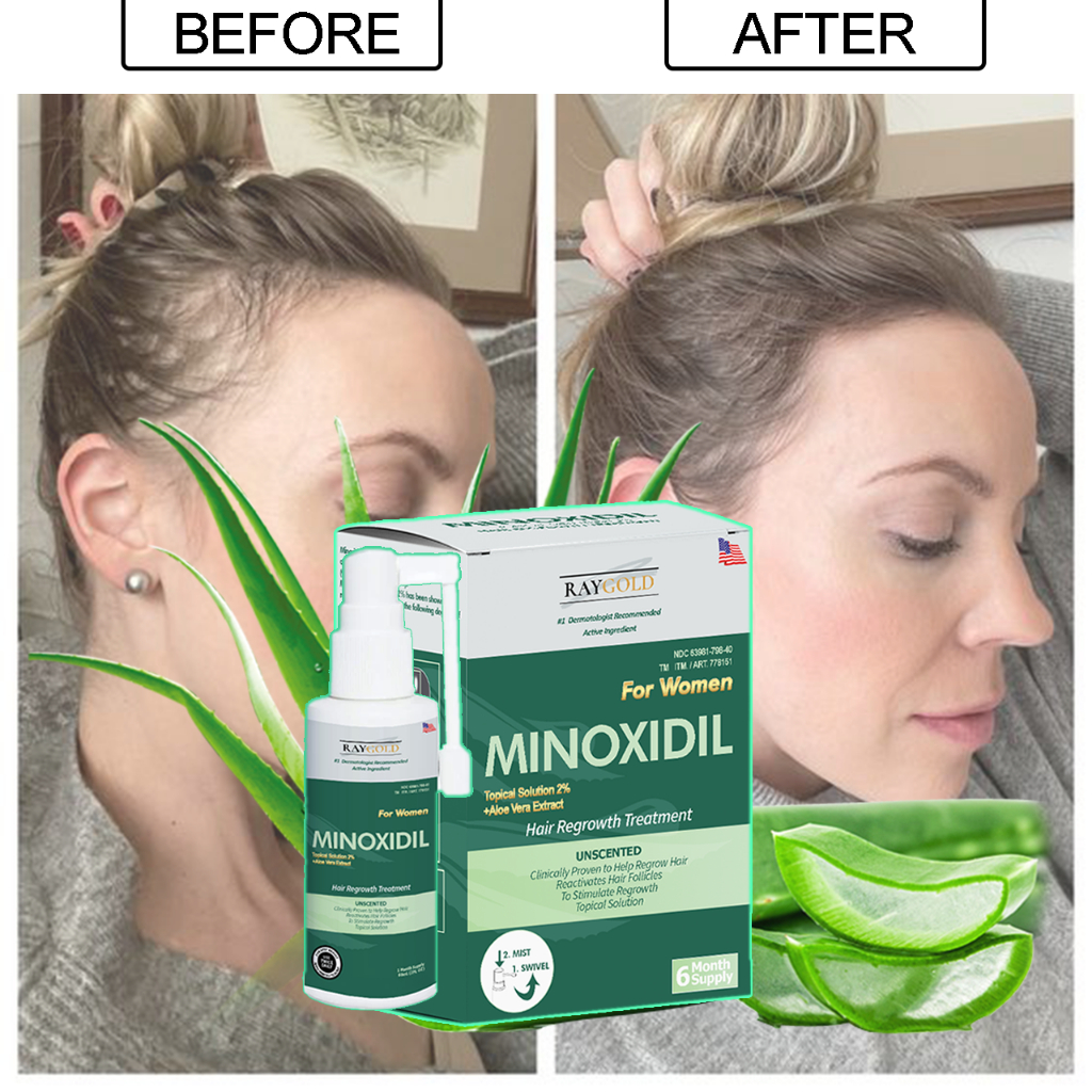 MINOXIDIL 2% for WOMEN penumbuh rambut &amp; anti rontok kebotakan with Aloe Vera extract made in USA - RAYGOLD - HAIR TONIC HAIRTONIC SERUM RAMBUT HAIR TONIK HAIRTONIK KIRKLAND BOURN HIMS ROEGAN ROGAINE