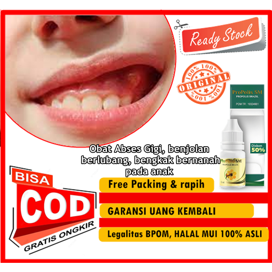 PROPOLIS SM - Obat Abses Gigi, benjolan, berlubang, bengkak bernanah, pada anak, sisa akar gigi, per