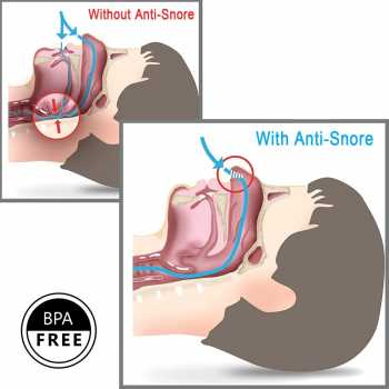 Alat Anti Ngorok Dengkur Pernafasan Hidung Stop Snoring Solution / Belt Stop Snoring Solution Alat Pencegah Ngorok Dengkur Mendengkur Kodok / Peredam Penghilang Dengkuran Ngorok Lembut Anti Lecet Pernafasan Hidung Tidur Nyenyak Penghilang Suara Mengigau