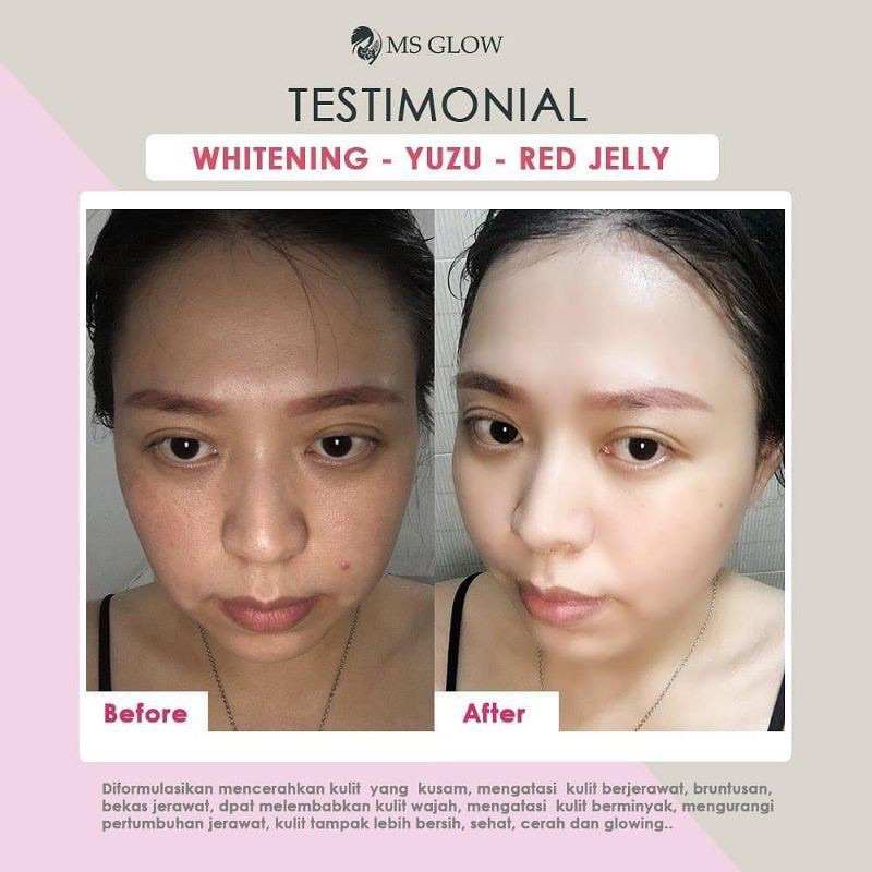 MS GLOW PAKET WHITENING / PAKET WHITENING MS GLOW