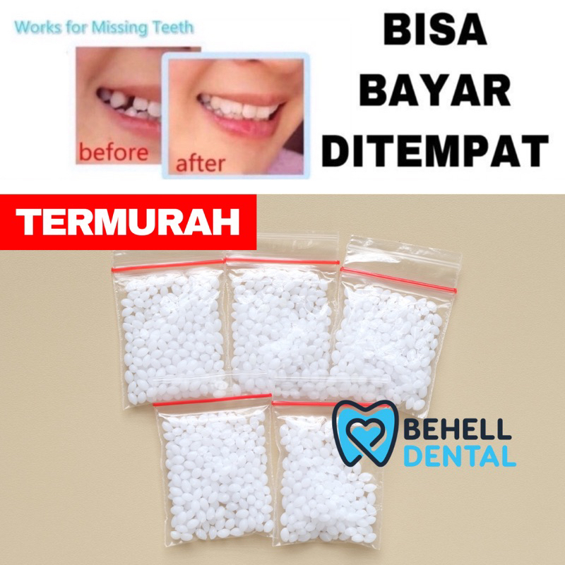 TEMPTOOTH 200 BUTIR - GIGI PALSU Penambal Gigi Renggang Bolong - Temporary Tooth Untuk Gigi Patah Gigi Berlubang Gigi Kelinci Gigi Gingsul - Temp Tooth Bahan Tambal Gigi Sementara Lem - Snap On Smile Behelldental