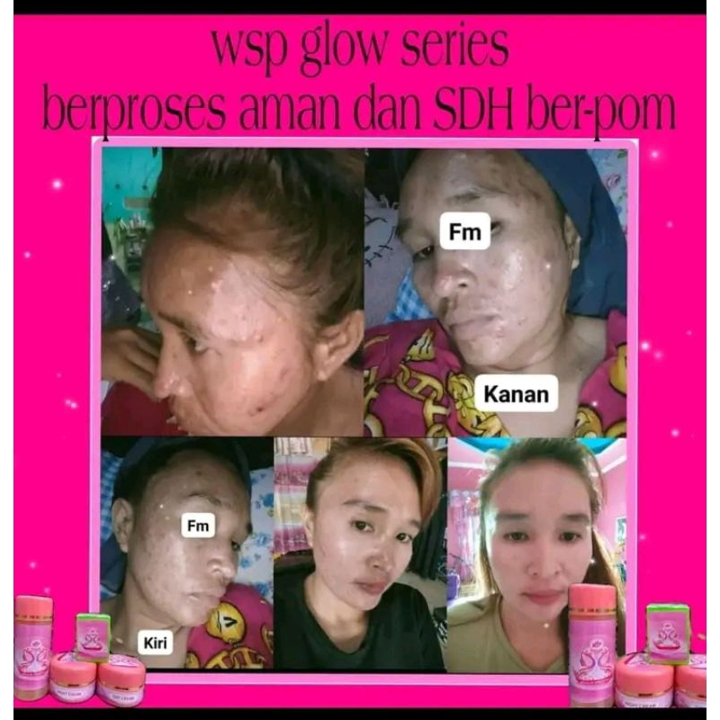 skincare wsp