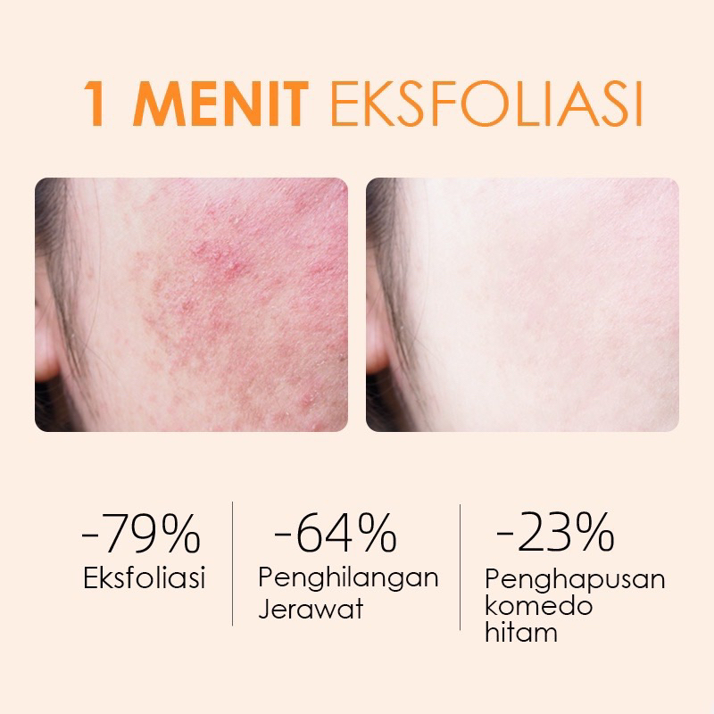 GMEELAN Exfoliating Gel Face Eksfoliasi Wajah Blackhead Clemaner Hydrating Gel With Niacinamide Improve Dull Skin