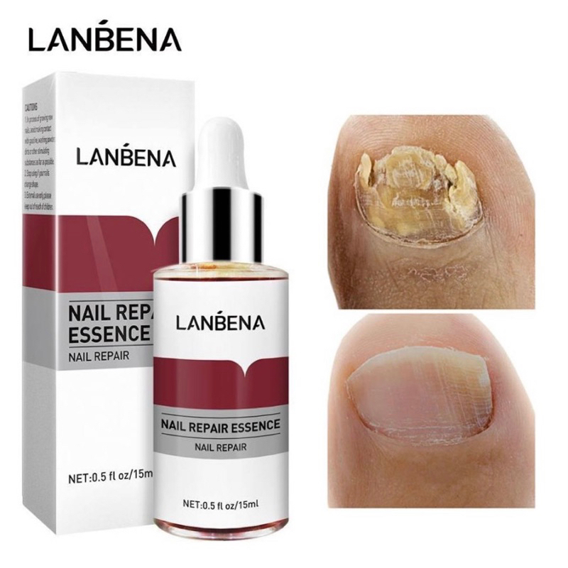Lanbena Nail Repair Essence