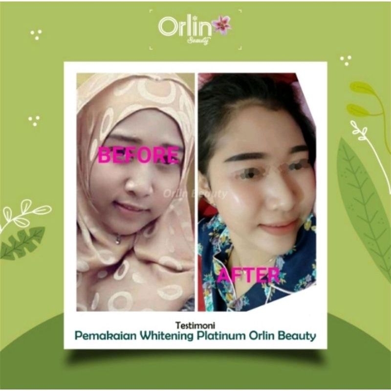 NEW ORLIN krim pemutih wajah BPOM ( whitening platinum bisa untuk bumil/busui )