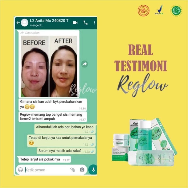 REGLOW Paket Perawatan Kecantikan Wajah Glowing | Glow Skin Treatment | Atasi Muka Jerawat Flek Hitam Milia Kusam | Skincare Skin Care BPOM Halal MUI | Sunscreen Whitening Anti-Aging | Aman Bumil Busui Skincare Reglow / Reglow skincare original dr. shindy