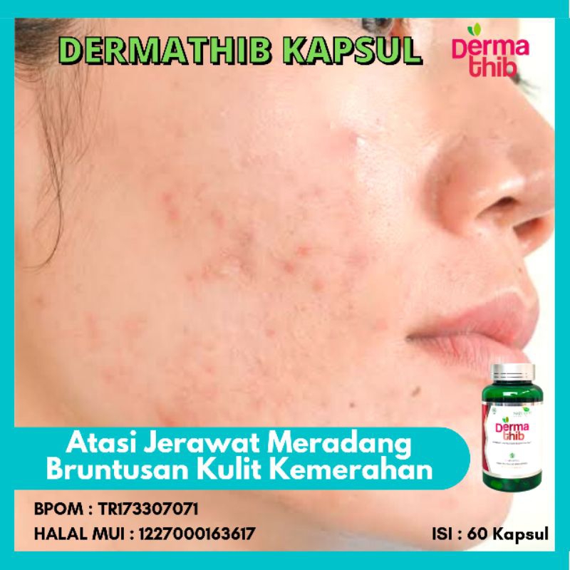 Dermathib Obat Jerawat Kemerahan Radang Kulit Wajah Alami / Dermathib Kapsul Radang Jerawat BPOM Pri
