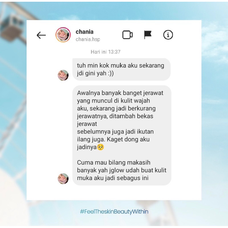 JGLOW TEEN SKINCARE KULIT NORMAL / JERAWAT 4PC