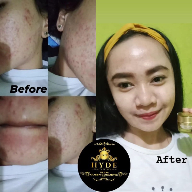 SERUM LEMON HYDE BEAUTY SKINCARE